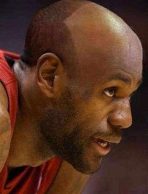 lebron james messed up hairline